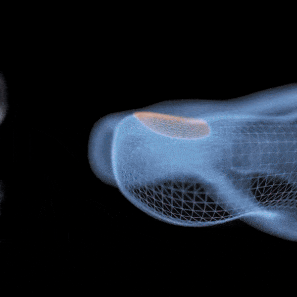 Handheld UV device held over the toenail to treat nail fungus at home