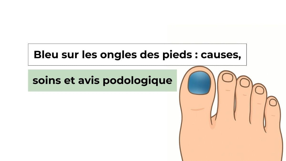 Bleu sur les ongles des pieds : causes, soins et avis podologique - Semello.fr