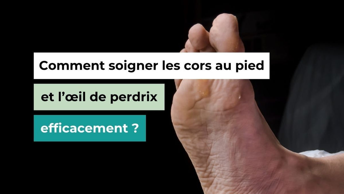 Comment soigner les cors au pied et l’œil de perdrix efficacement ? - Semello.fr