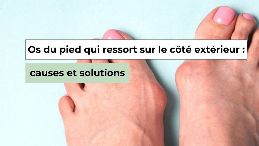 Comment soulager et prévenir un os du pied qui ressort sur le côté extérieur ? - Semello.fr