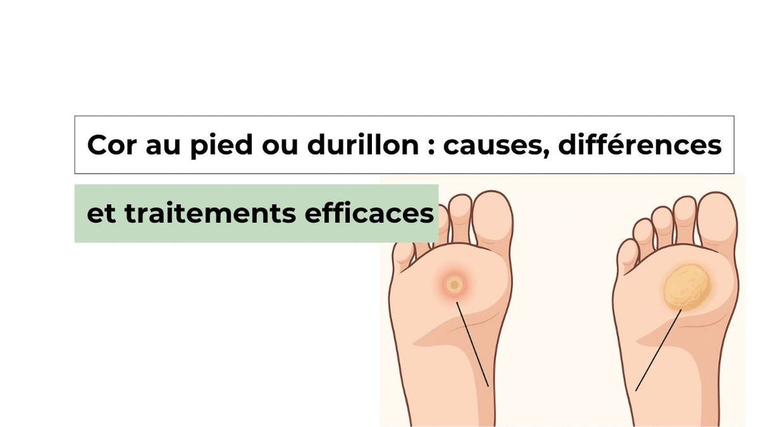 Cor au pied ou durillon : causes, différences et traitements efficaces - Semello.fr