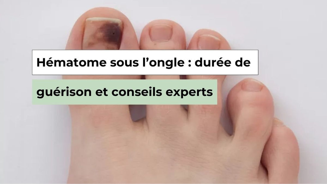 Hématome sous l’ongle : comprendre la durée et les étapes de guérison - Semello.fr