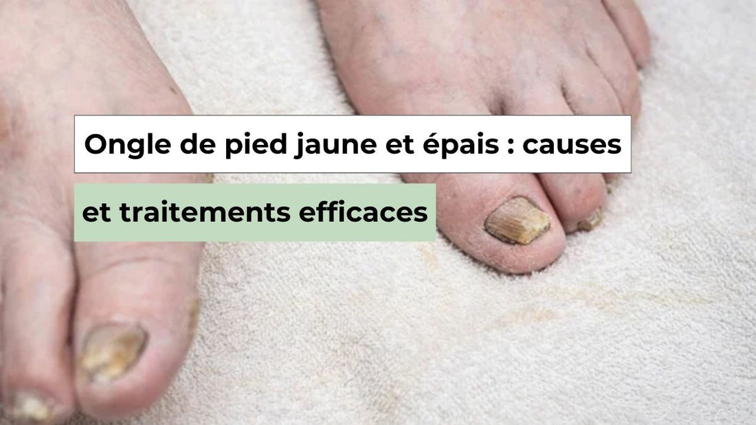 Ongle du pied jaune et épais : pourquoi cela arrive et comment le traiter - Semello.fr