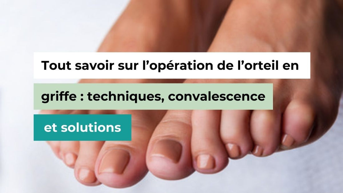 Tout savoir sur l’opération de l’orteil en griffe : techniques, convalescence et solutions - Semello.fr