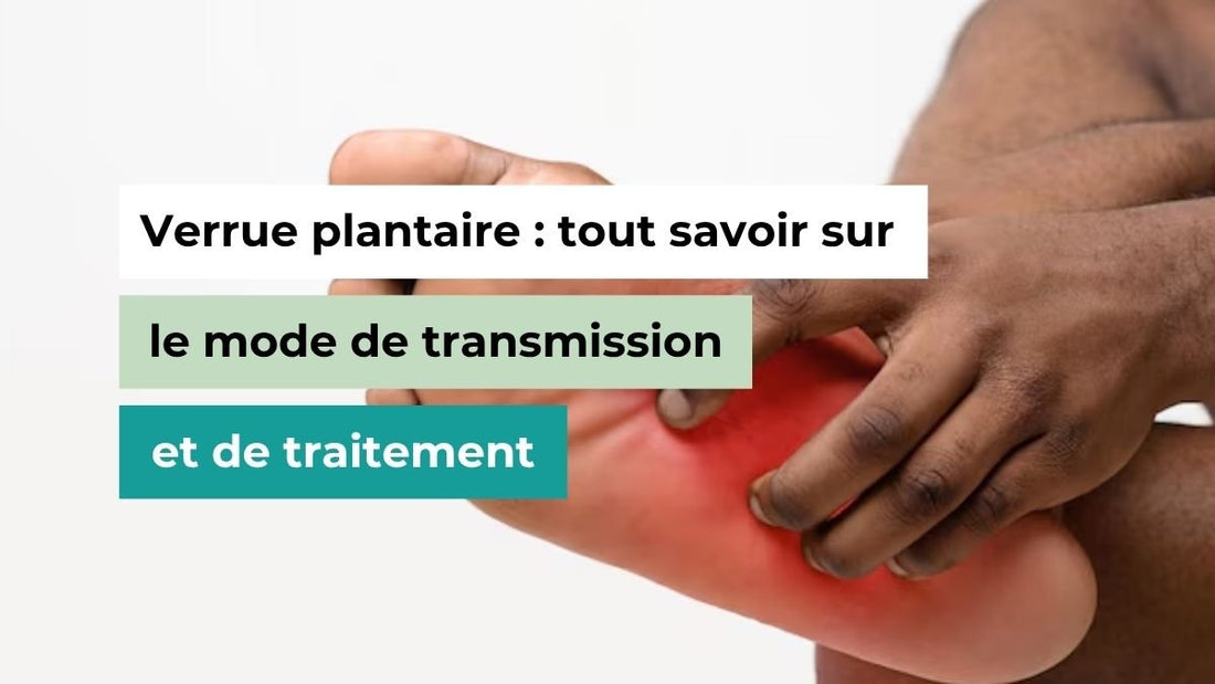 Verrue plantaire : tout savoir sur le mode de transmission et de traitement - Semello.fr