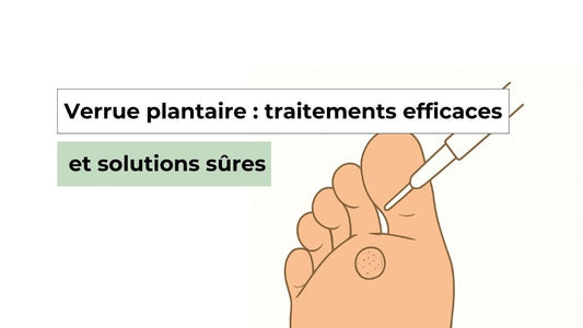 Verrue plantaire : traitements efficaces et solutions validées par les experts - Semello.fr