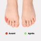 Small silicone sleeve slipped over the little toe to cushion rubbing