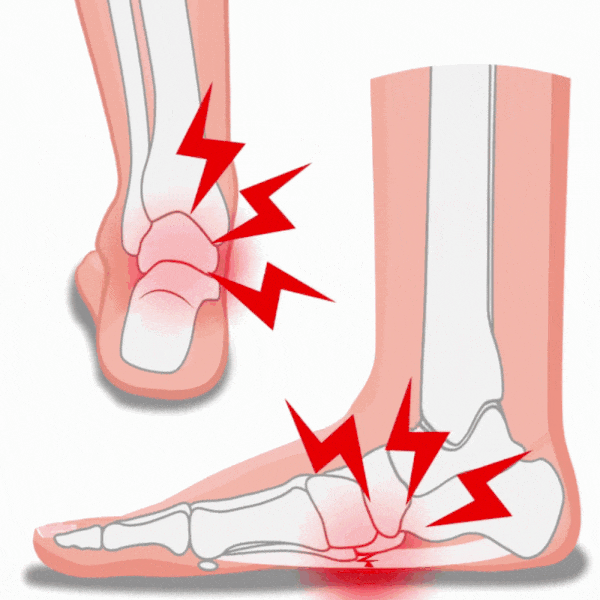 Orthopedic insoles for everyday foot pain, contoured under the arch and the heel