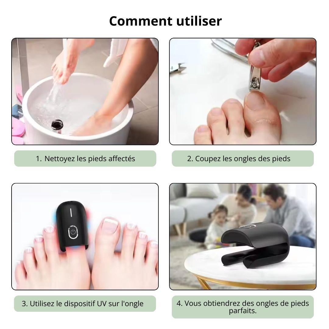 Handheld UV device held over the toenail to treat nail fungus at home