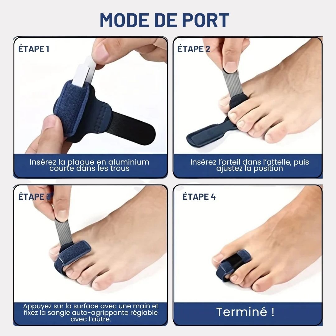 Claw toe correction splint that cradles the toes and holds them flat inside the shoe