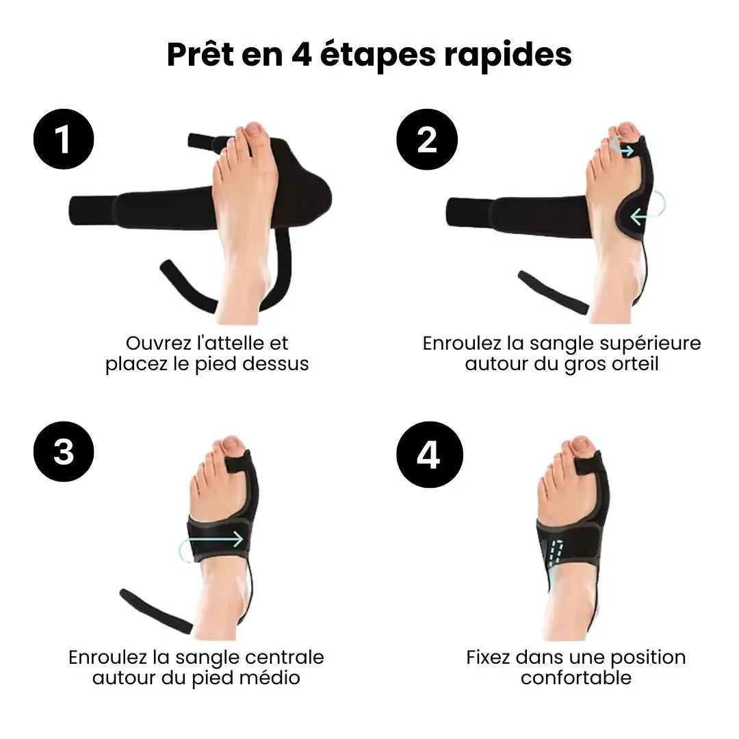Adjustable night splint strapped across the forefoot to hold the big toe straight