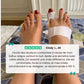 Hinged bunion splint worn over the big toe joint, letting the foot flex while it corrects