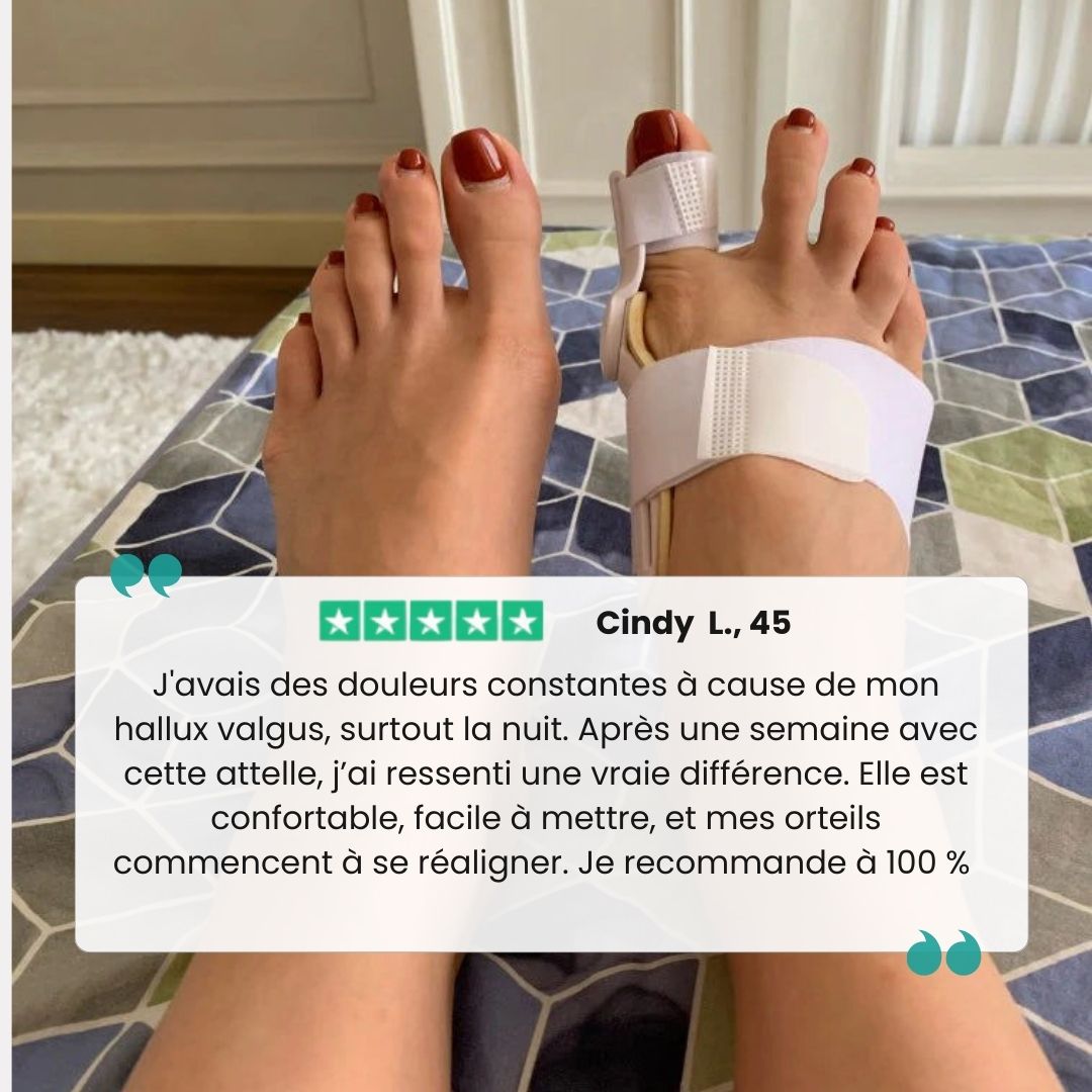 Hinged bunion splint worn over the big toe joint, letting the foot flex while it corrects