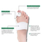 Bunion night splint strapped across the forefoot to hold the big toe straight overnight