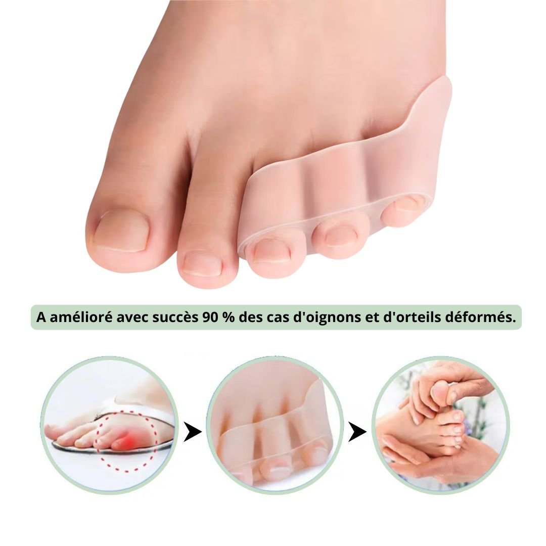 Silicone bunionette splint that slips over the little toe to shield the joint