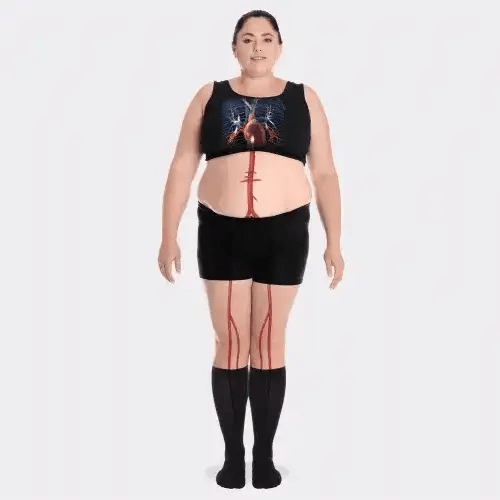 Two-tone 20-30 mmHg compression socks worn up the calf, in black, pink, blue and light blue
