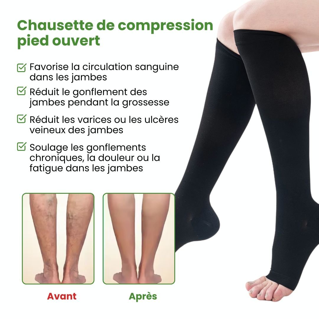 Breathable open-toe compression socks in black and beige, worn up the calf