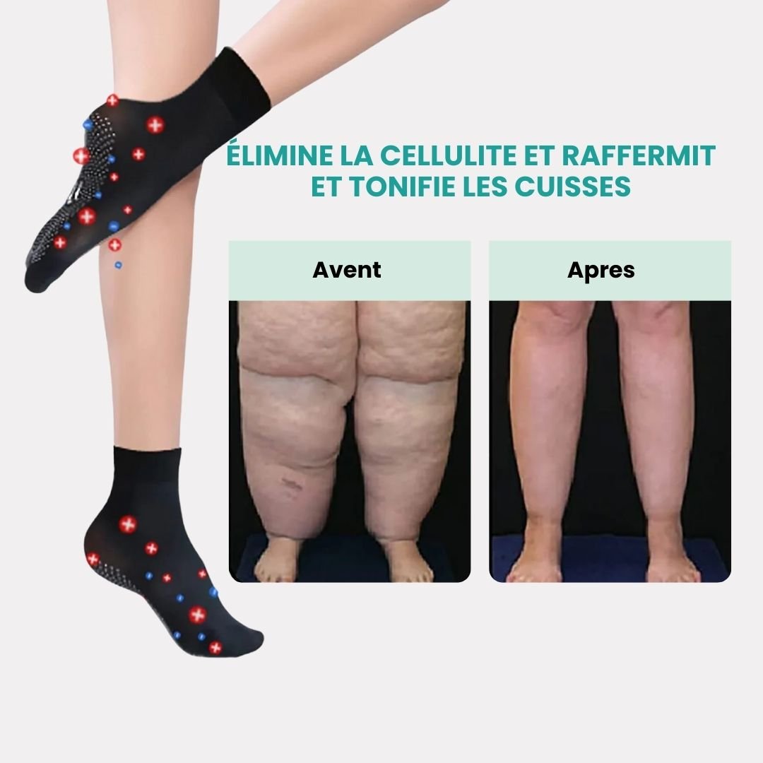 Knee-high massage socks with textured knit pressure zones along the calf