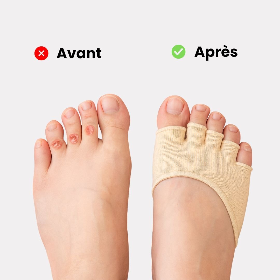 Toe separator socks that spread and hold each toe apart, in black and beige
