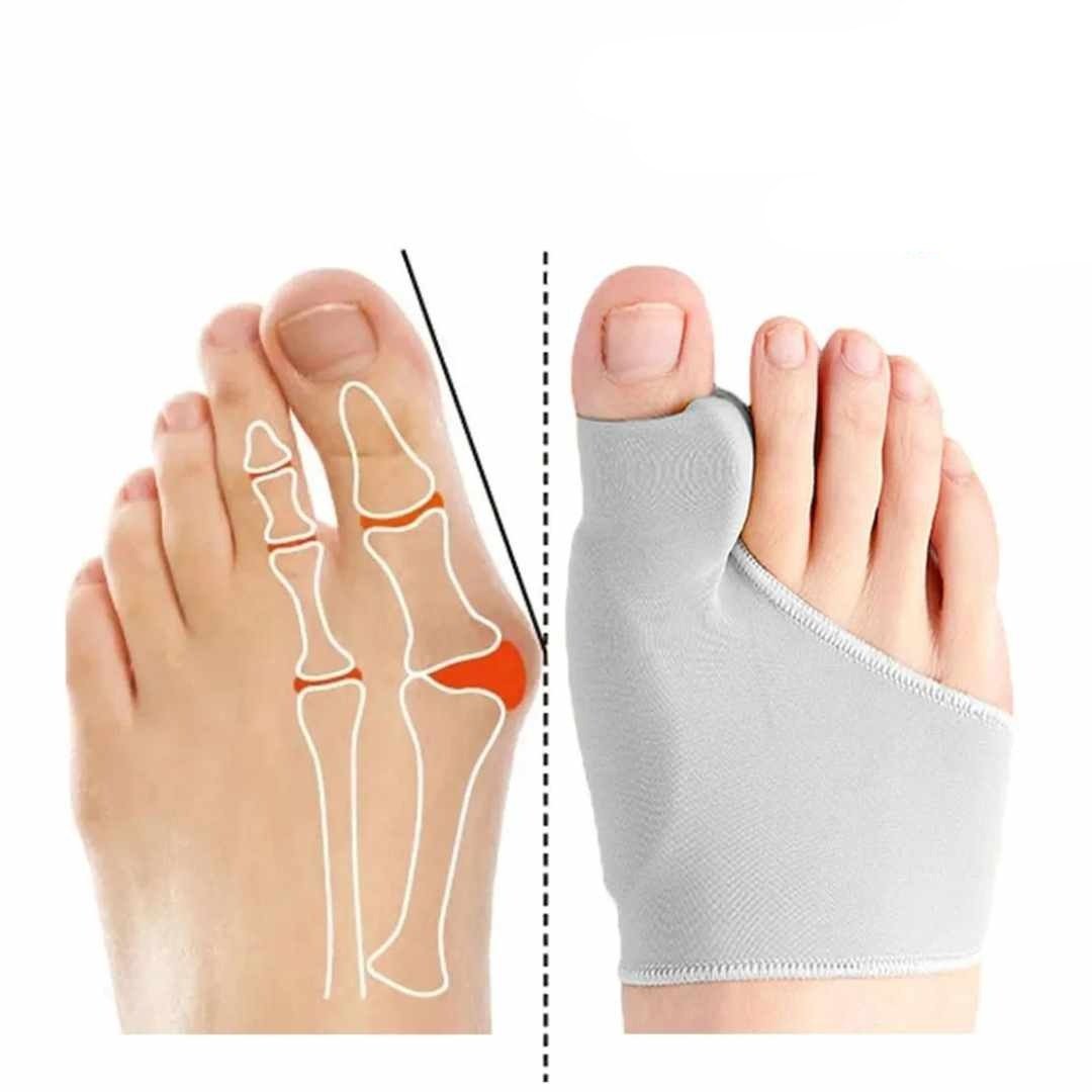 Bunion care kit with a corrector and supporting pieces worn around the big toe joint
