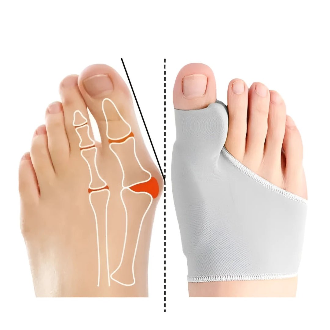 Bunion relief kit with a toe corrector and separators, in purple, blue, red and gray