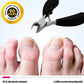 Ingrown toenail clippers with narrow angled blades and a wide ergonomic handle