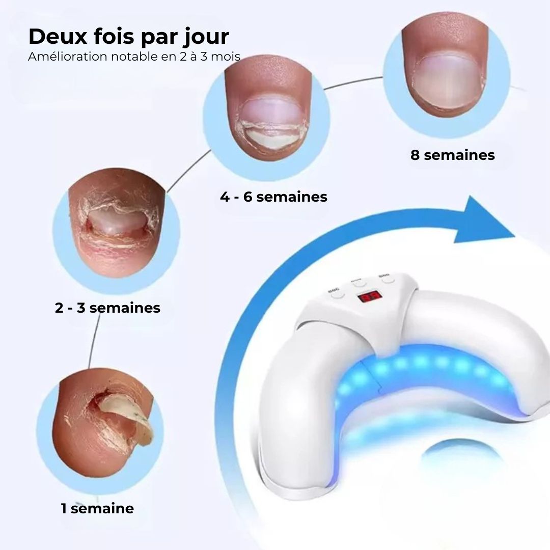 Handheld light therapy device held over the toenail to treat nail fungus