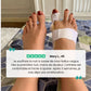 Rigid adjustable splint strapped around the foot to realign the big toe overnight