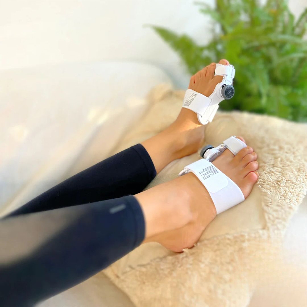 Adjustable bunion corrector strapped over the big toe joint for hallux valgus