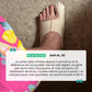 Lightweight correction sleeve worn over the bunion to realign the big toe
