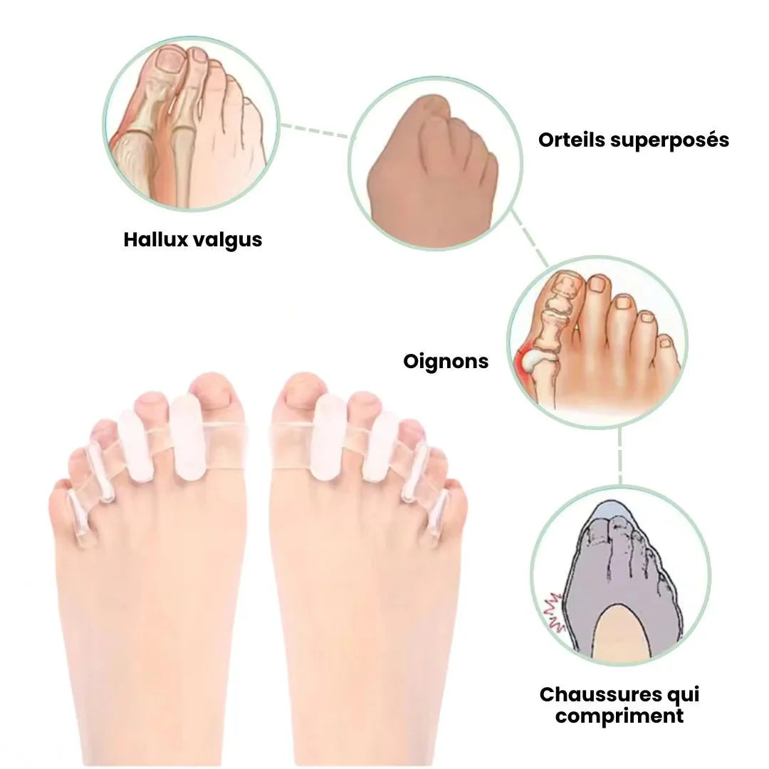 Toe straightener slipped under the claw toes to hold them flat