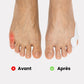 Soft silicone sleeve slipped over the little toe to cushion rubbing