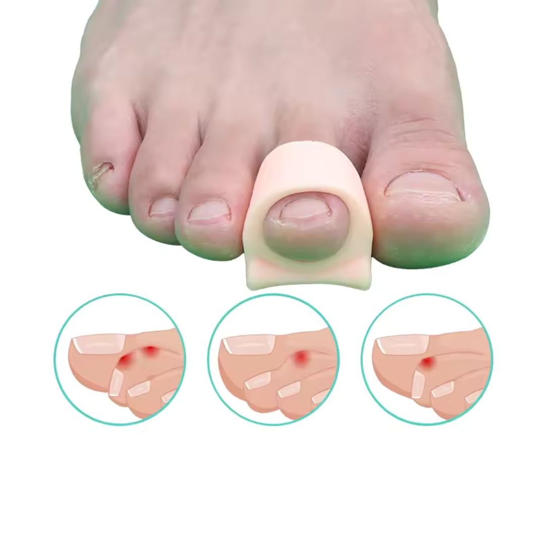 Adjustable claw toe corrector that straightens the curled toe inside the shoe