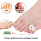 Adjustable claw toe corrector that straightens the curled toe inside the shoe