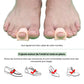 Adjustable claw toe corrector that straightens the curled toe inside the shoe