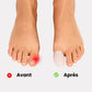 Soft sleeve worn over the big toe to cushion pressure inside the shoe