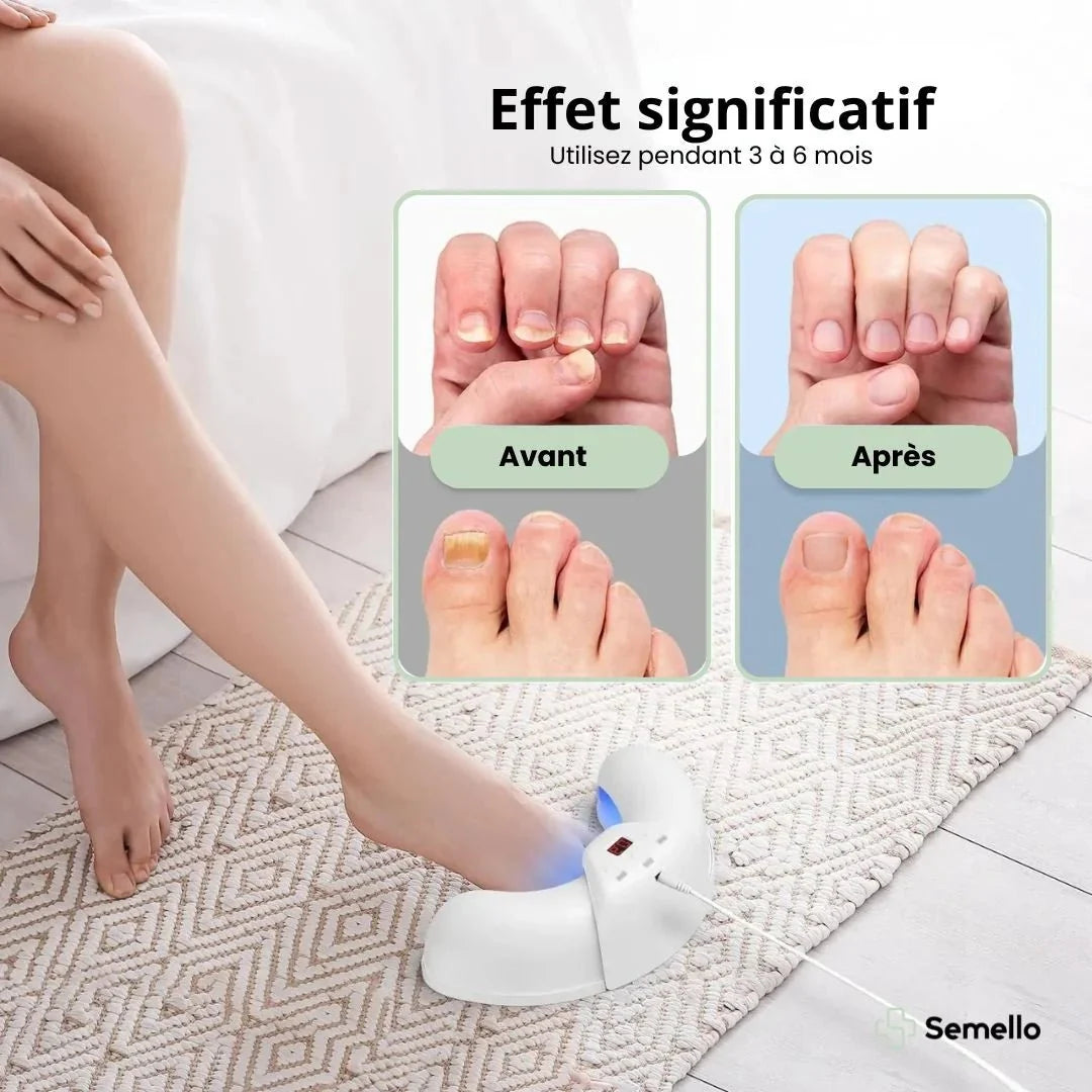 Handheld light therapy device held over the toenail to treat nail fungus