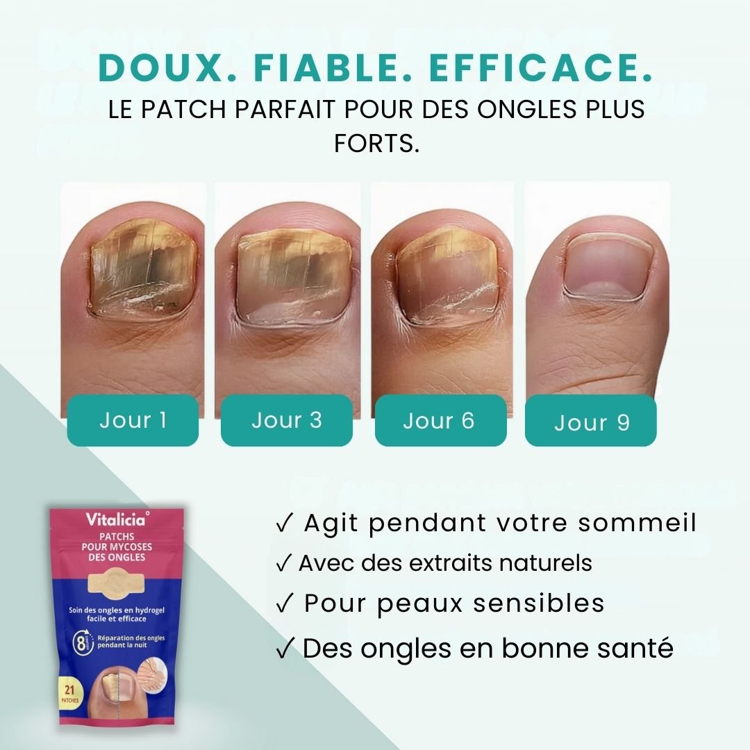 Toenail fungus kit with adhesive patches worn on the nail and a brush-tip serum