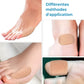 Thin adhesive anti-friction patches placed over the bunion at the base of the big toe