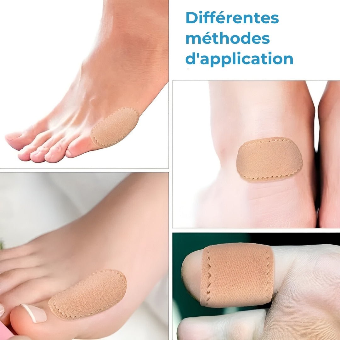 Thin adhesive anti-friction patches placed over the bunion at the base of the big toe