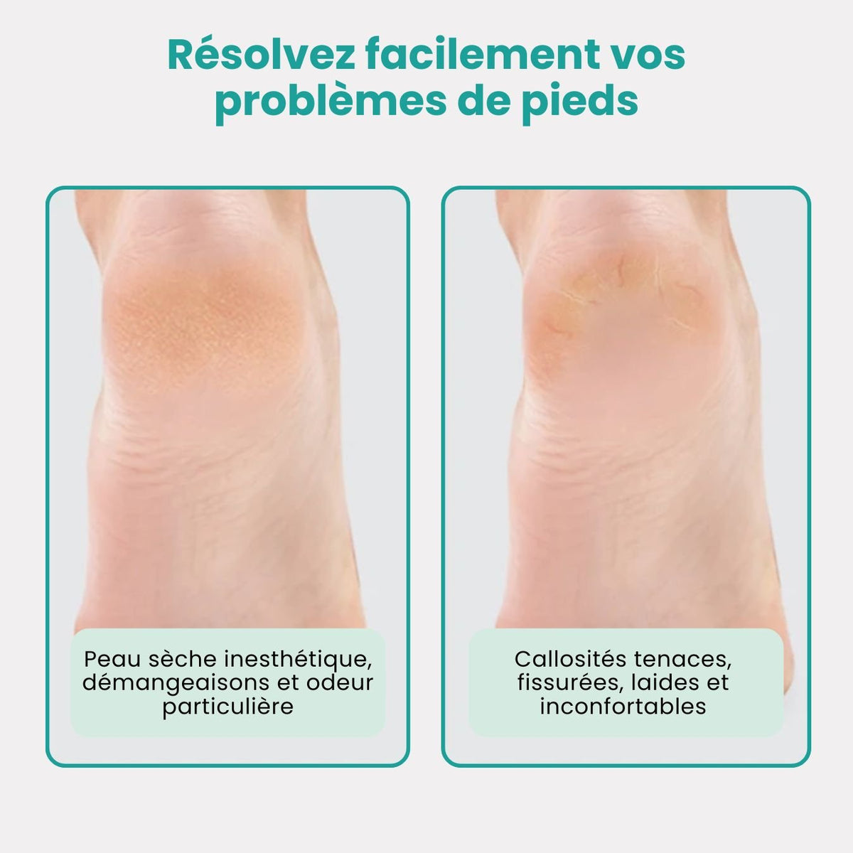 Foot file with a long handle and an abrasive head for smoothing calluses on the heel