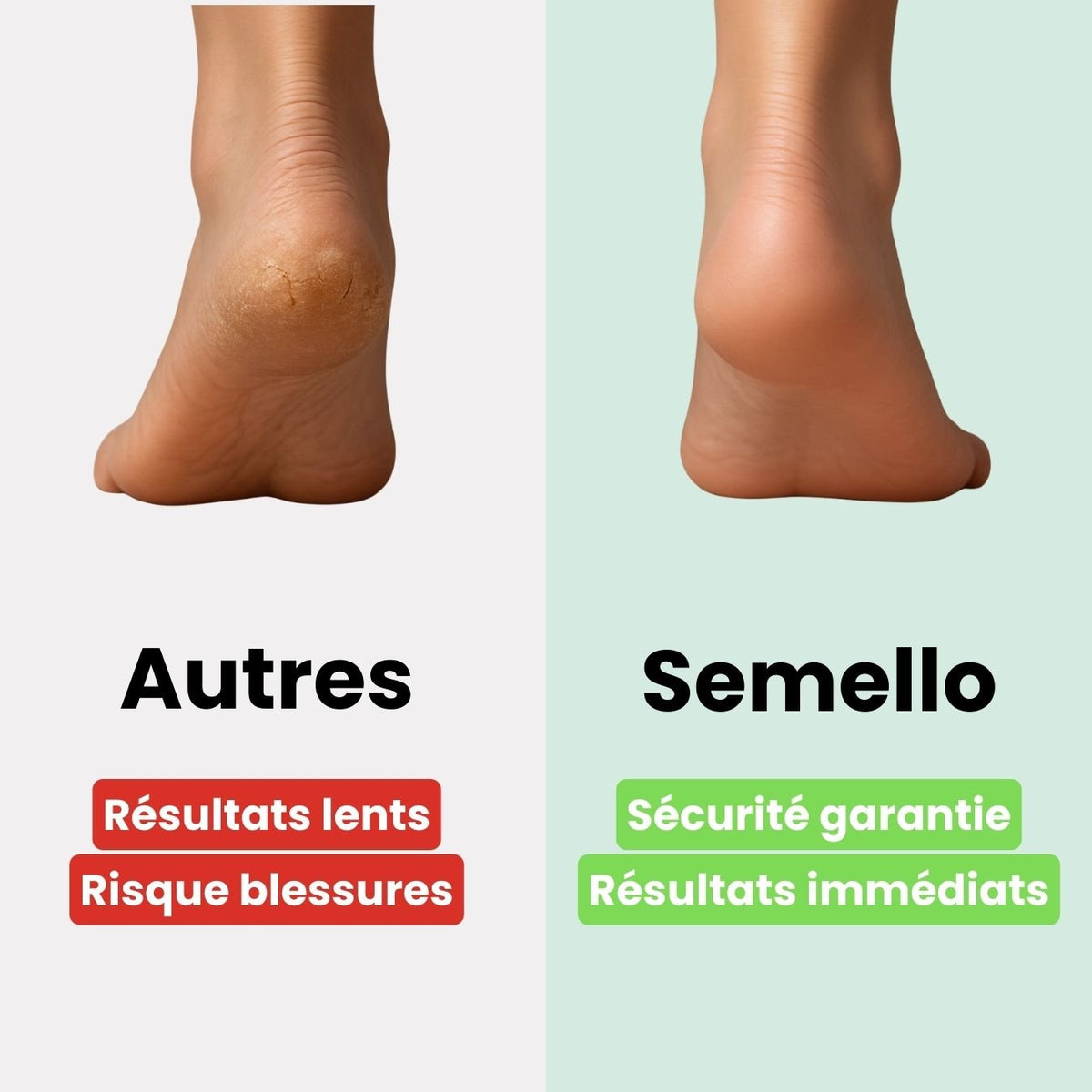 Foot file with a long handle and an abrasive head for smoothing calluses on the heel