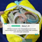 Zippered mesh shoe washing bag for the machine, in yellow, dark gray and light gray