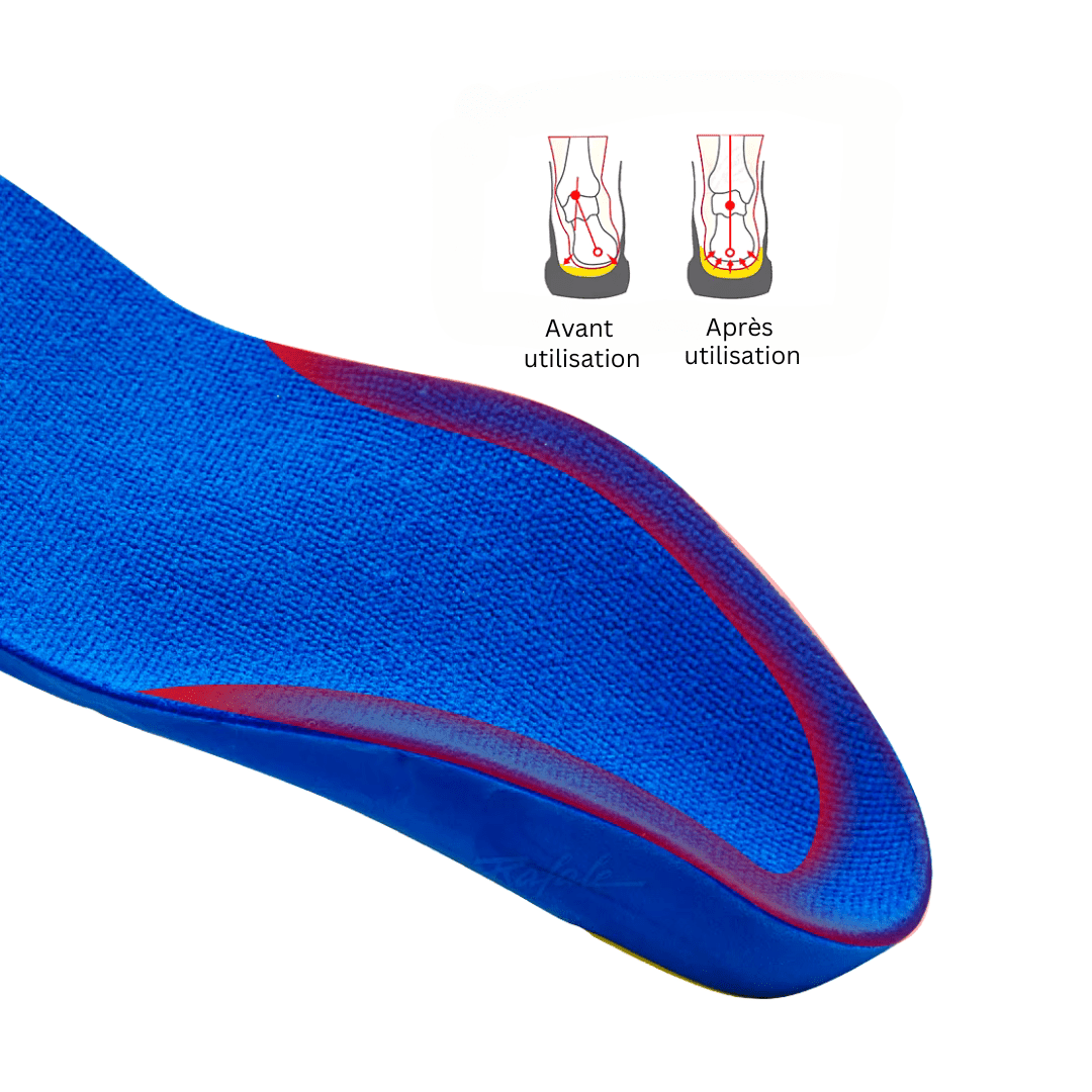 Orthopedic insoles for kids with a molded arch that corrects foot alignment
