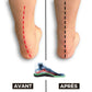 Orthopedic insoles for everyday foot pain, contoured under the arch and the heel