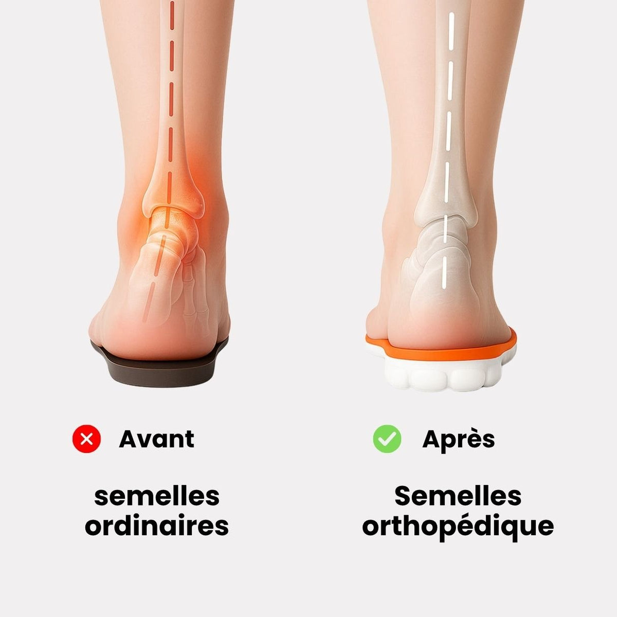 Pair of memory foam orthopedic insoles with a raised arch, worn inside the shoe