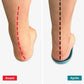 Orthopedic insoles for bunions with a heel cushion, arch support and metatarsal pad