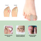 Soft flexible separators slipped between the toes to ease a hammer toe