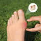 Soft flexible separators slipped between the toes to ease a hammer toe