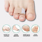 Fabric strap looped around the toes and forefoot to straighten a claw toe